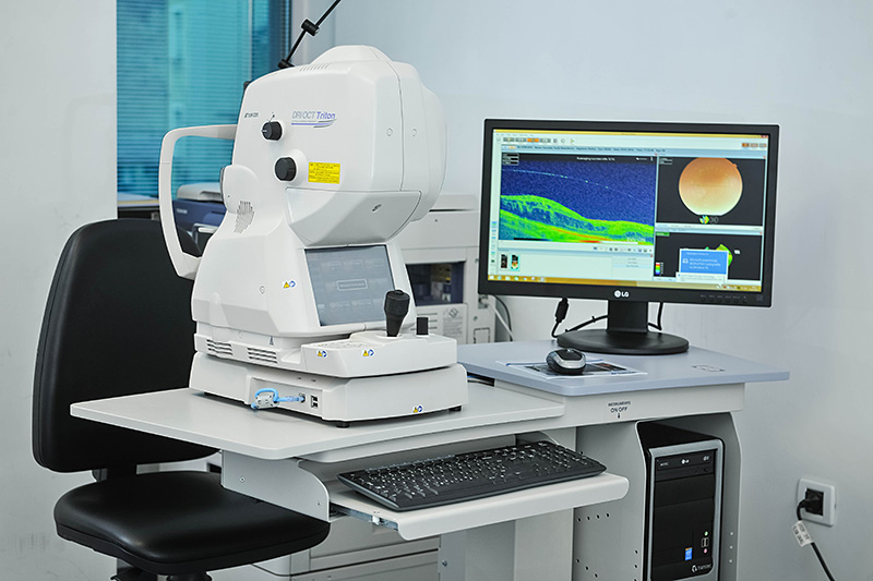 Opticka koherentna tomografija oct