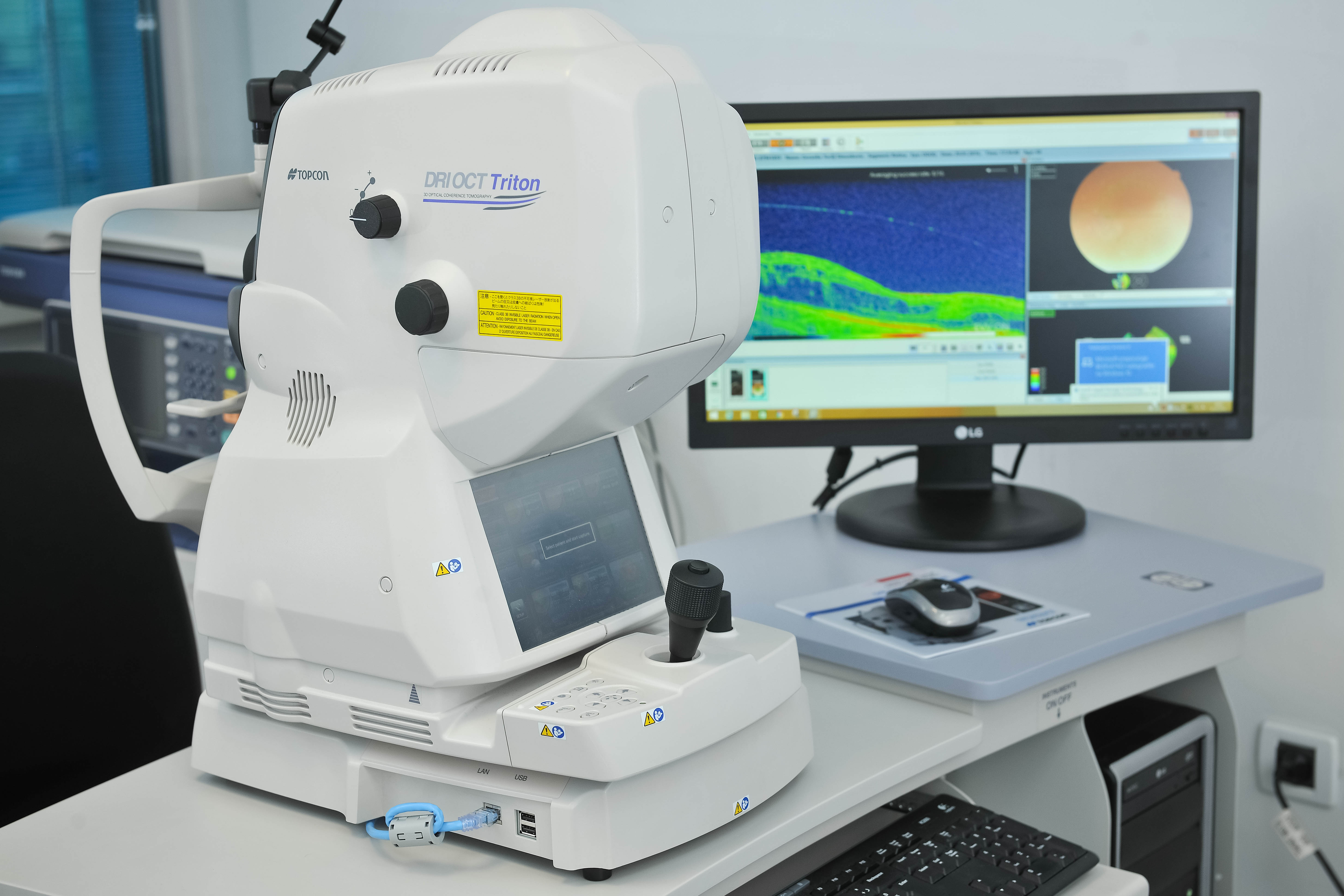 TRITON TOPCON SWEPT SOURCE OCT - uređaj za slojevno snimanje makule i retine