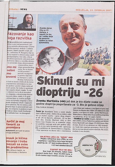 Skinuli su mi dioptriju -26 (24 sata, 2007.)