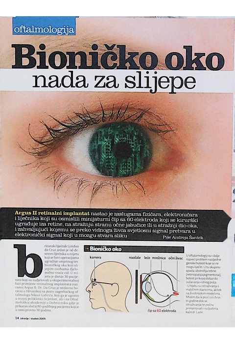 Bioničko oko (2009.)